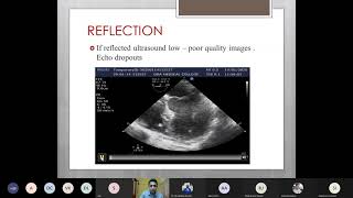 Physics in Echocardiography  Image Optimization by Dr Sushmit Kamat [upl. by Inihor743]