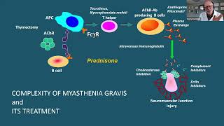 Management of autoimmune disorders in patients with thymic epithelial tumors [upl. by Manella]