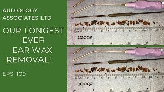 OUR LONGEST EAR WAX REMOVAL YET  EP 109 [upl. by Romelle]