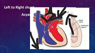 Congenital Heart DiseaseTamil Mightymedicoz [upl. by Hiltner845]