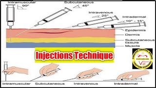 injection techniquesim injection subcutaneous injectionIntradermal injection [upl. by Adler]