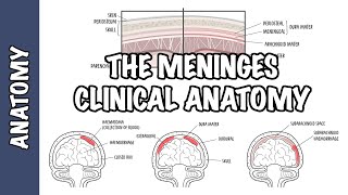 Clinical Anatomy  Meninges Intracranial hematoma subdural epidural subarachnoid and meningitis [upl. by Rento]