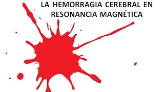 RESONANCIA MAGNÉTICA NUCLEAR ANEXO 8 La hemorragia cerebral en IRM [upl. by Murvyn]