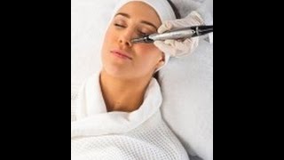 Dermapen  mezoterapia mikroigłowa  Aestetic Clinic [upl. by Vacuva]