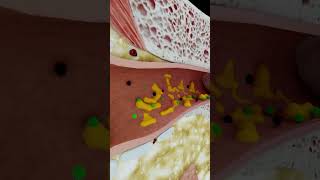 Why Earwax Matters short earwax  creativelearning3d [upl. by Ynos434]