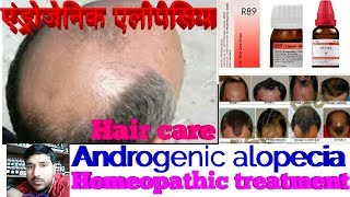 Androgenic alopecia Ganjapan ka ilaj  Homeopathic medicine for Androgenic alopecia Explain [upl. by Anir]