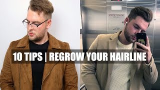 10 Quick Tips How To Stop A Receding Hairline amp Receding Hairline Regrowth [upl. by Arema527]