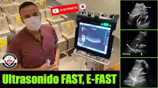 Ultrasonido FAST EFAST en menos de 3 minutos By Orlando PérezNieto [upl. by Marinelli]