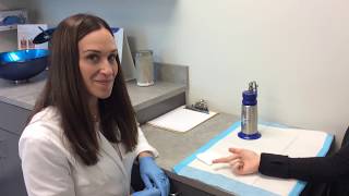 Wart Removal Using Liquid Nitrogen [upl. by Gustin]