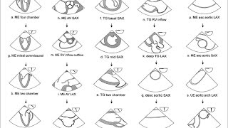 Comprehensive Transesophageal Echocardiograhic TEE Examination [upl. by Atinot238]