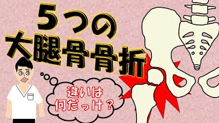 【違いは何？】５つの大腿骨骨折！各病態や合併症を７分で簡単解説♪ [upl. by Heshum519]