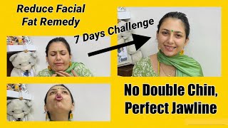 How to reduce Face Fat  No Double Chin Chubby Cheek  Get Slim Face and Jawline  Dr Upasana Vohra [upl. by Ahsenyt167]