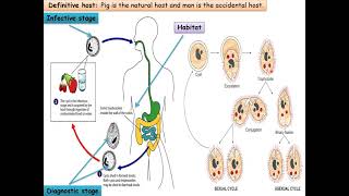 MED LEVEL2 GIT Balantidium coli [upl. by Arva]