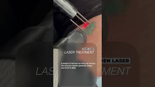 how to remove a tattoo from home without cost 👌🏻  remove permanent tattoo without laser [upl. by Tita]