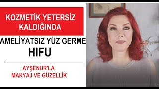 Ameliyatsız Yüz Germe  Gıdı Sorunu [upl. by Atiniv]