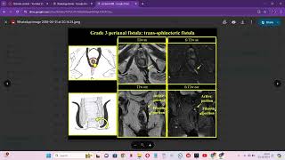 RADIOLOGY EXAM CASES [upl. by Anole878]