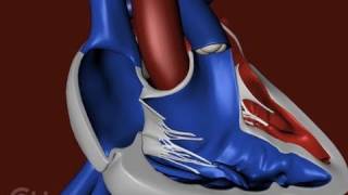 The Structure of a Heart with Tetralogy of Fallot TOF  The Childrens Hospital of Philadelphia [upl. by Neleh750]