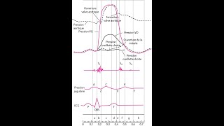 DIU CPC 2021 Cathétérisme cardiaque diagnostique par François Godart [upl. by Anilrahc]