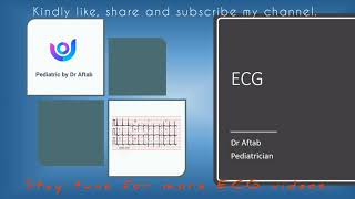 Electrocardiography ECGEKG  Rate amp Rhythm  EKG  RCPCH [upl. by Telimay161]