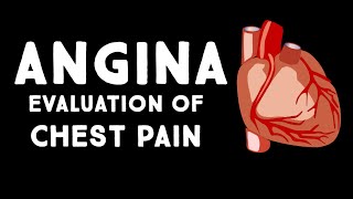 Angina Pectoris  An Approach To Chest Pain amp Acute Coronary Syndrome  Stable amp Unstable Angina [upl. by Gwendolyn7]