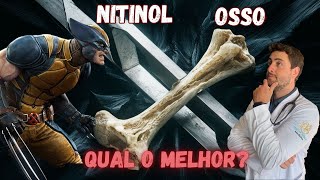 NITINOL VS OSSO QUAL O MELHOR [upl. by Akissej960]