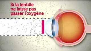 Lentilles de contact  attention les yeux [upl. by Richter219]