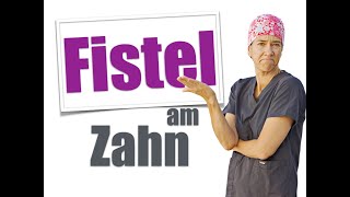 FISTEL am ZAHN WAS ist das WO kommt das her Tipps vom ZAHNARZT [upl. by Tilly385]