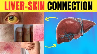 😱 Is Your Skin SCREAMING for Help 🆘 11 LIVER WARNING Signs You Might Miss  Longevity Deprocessed [upl. by Lothaire]