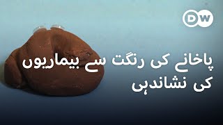 آپ کا پاخانہ کسی موذی مرض کی نشاندہی کر سکتا ہے؟  DW Urdu  Human Waste A Mirror to Our Health [upl. by Ciri]