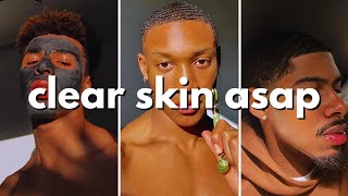 how to get clear skin for guys asap no bs guide [upl. by Reidid]