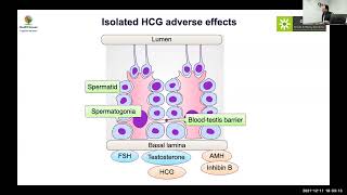 MedEClasses Module Hypogonadotropic Hypogonadism Treatment [upl. by Valentin468]