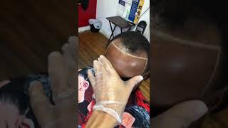 HAIRLINE REPAIR How to fix your hairline [upl. by Spain560]