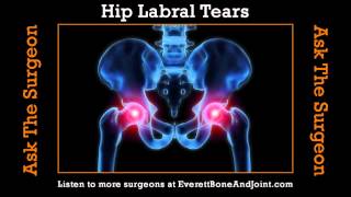 Hip Labral Tears [upl. by Abisia412]