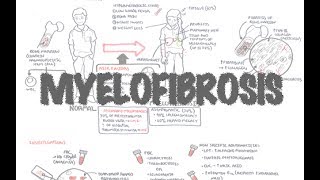 Primary Myelofibrosis  Overview presentation pathophysiology investigation treatment [upl. by Drauode]