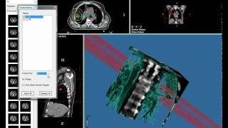 Fratoria DICOM RT Viewer showing a 4D DICOM RT dataset [upl. by Mary]