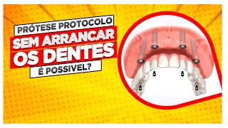 Existe prótese dentária do tipo protocolo sem arrancar os dentes [upl. by Ella]