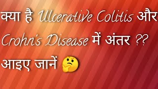 Ulcerative Colitis Versus Crohns Disease in Hindi Language [upl. by Graehl]