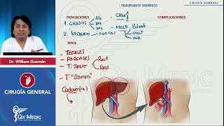 CIRUGÍA GENERAL Cirugía hepática Trasplante hepático mp4 [upl. by Cassidy]