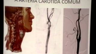 ANGIOGRAFIA CEREBRAL  PARTE 1 [upl. by Javed]