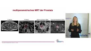 Diagnostik und Therapie beim Prostatakarzinom  Prof Dr Cordula Jilg [upl. by Victory475]