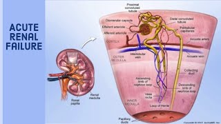 Acute renal failure prerenalrenal and post renal azotemia [upl. by Noivart928]