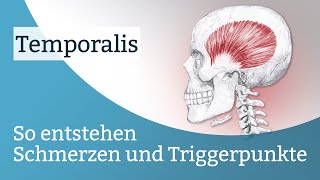 Temporalis Schmerzen Triggerpunkte und deren Aktivierung [upl. by Krawczyk]