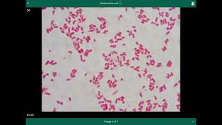 escherichia coli  الإشريكية القولونية [upl. by Doughty]