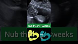 Nub theory 13weeksultrasoundpreganacy baby shorts [upl. by Albertina]