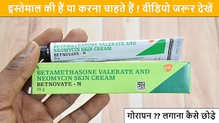 Betnovate N Skin Cream Review  Side Effects  Real Uses  गोरा बनाने वाली क्रीम का सच [upl. by Sida]