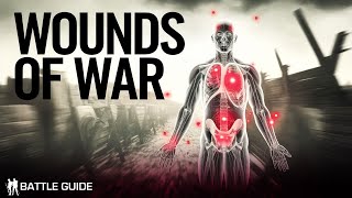 Wounded on The Western Front  A Death Sentence WW1 Documentary [upl. by Demetria]