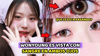 WONYOUNG ES VISTA CON SANGRE EN AMBOS OJOS  FANS CRITICAN A SU COMPAÑIA POR HACERLA TRABAJAR [upl. by Nilra771]