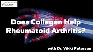 Does Collagen Help Rheumatoid Arthritis [upl. by Anwahsal]