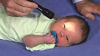 physical exam Newborn NormalBehavior [upl. by Haye]