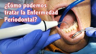 Enfermedad Periodontal II ¿Cómo podemos tratar la enfermedad periodontal [upl. by Laurice129]